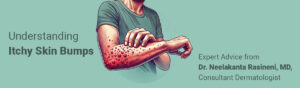 Itchy-Skin-Bumps