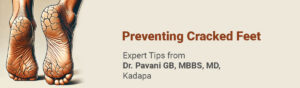 Preventing-Cracked-Feet-01